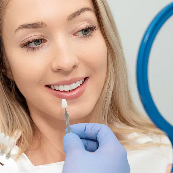 teeth whitening in renton wa