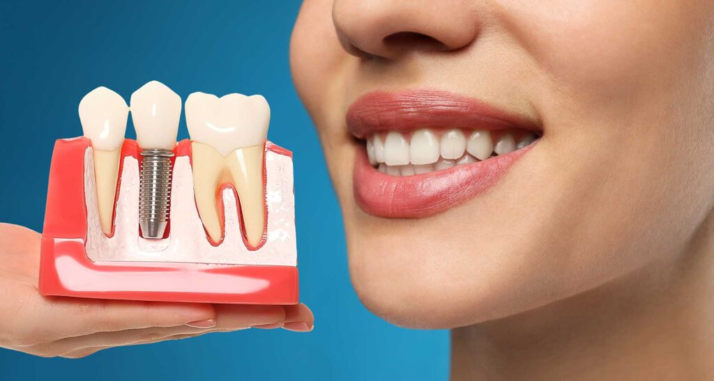 dental implant candidate-1