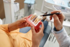 Dental implant parts displayed