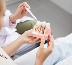 Holding tooth dental implant